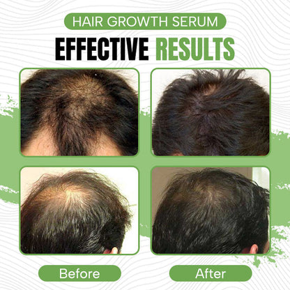 Hair Maximum Herbal Hair Growth Serum